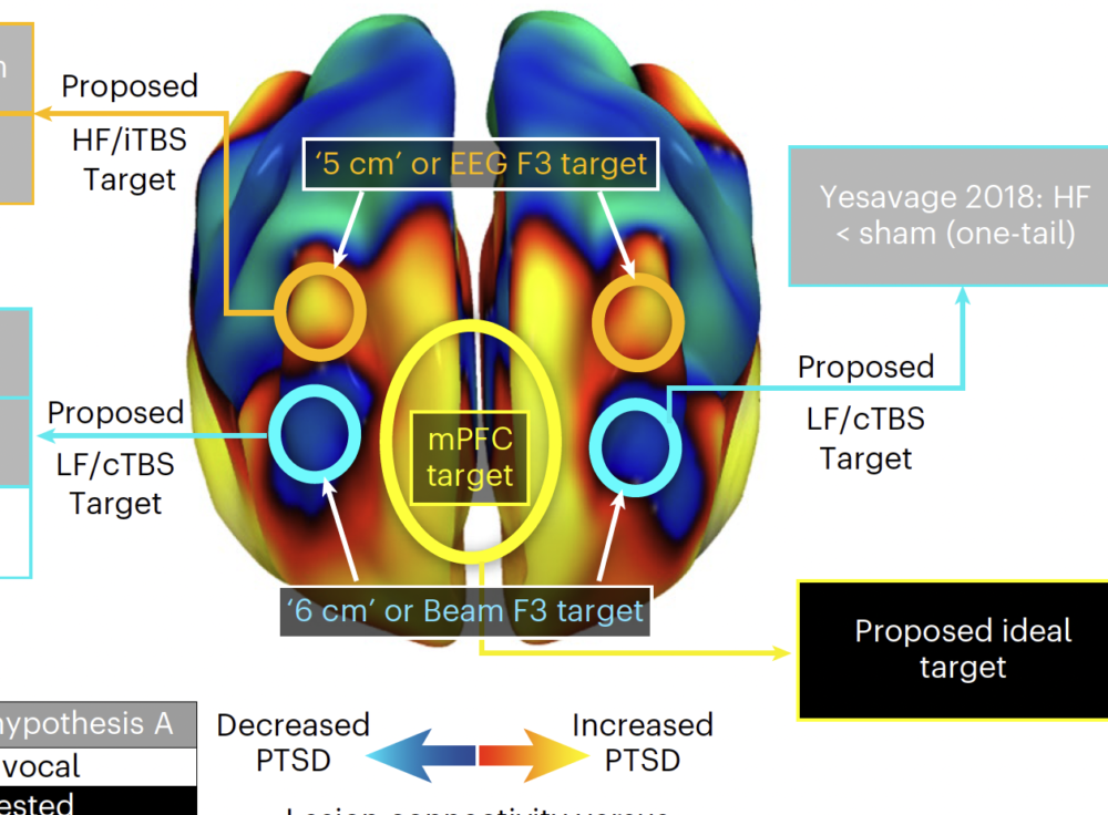 A potential target for noninvasive neuromodulation of PTSD symptoms derived from focal brain lesions in veterans (Nature Neuroscience, 2024) — original study image
