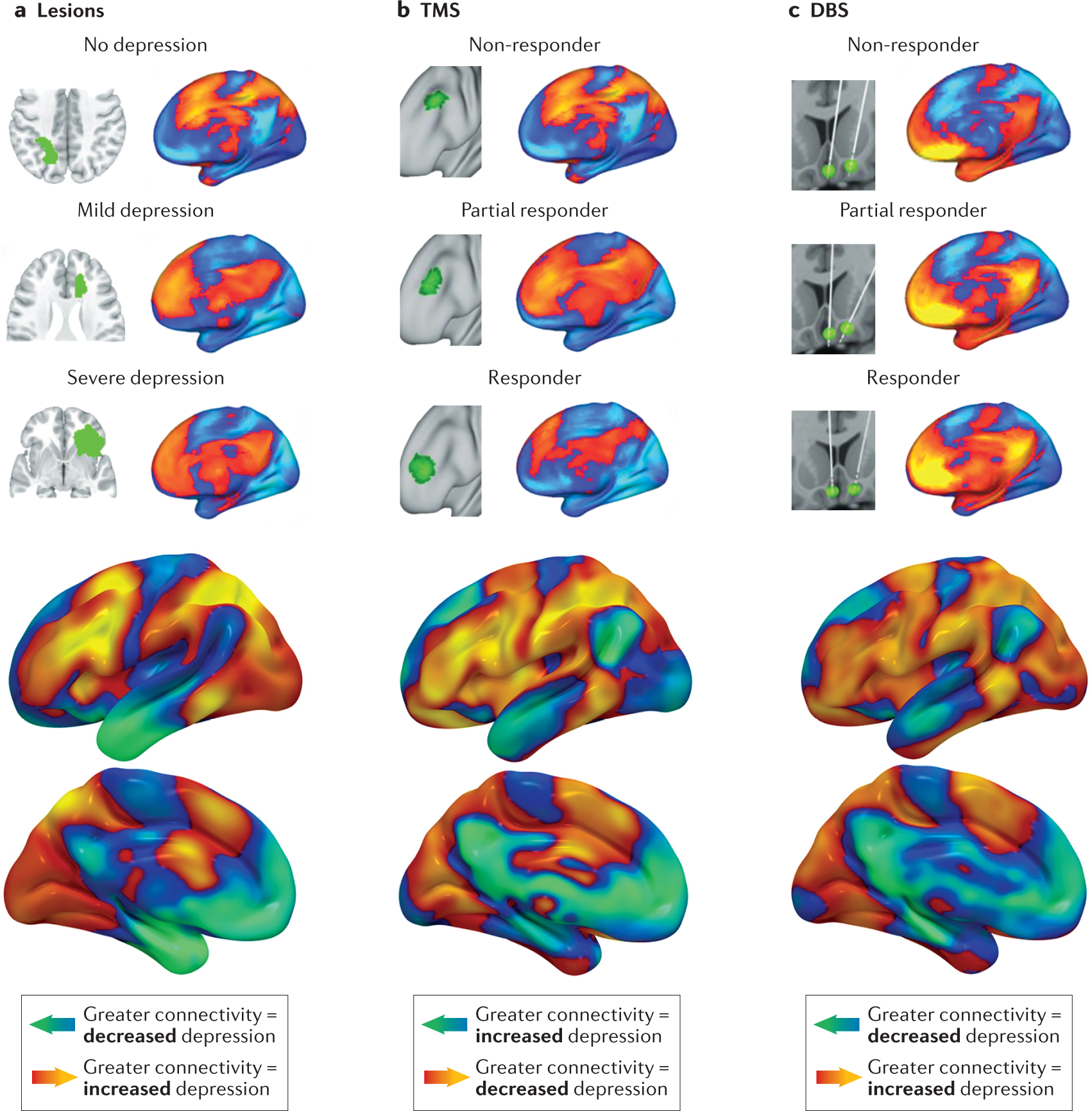 Figure 5: comparison of lesion, TMS, and DBS connectivity maps.