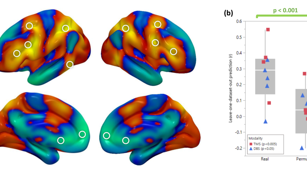 Depression circuit maps from the original study.