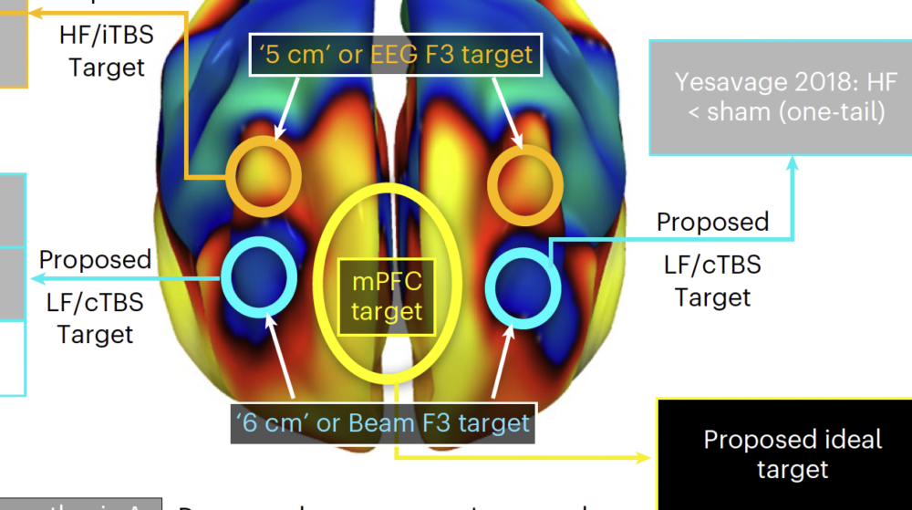 Brain circuit figure from the PTSD study.